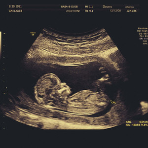 992人人tv香蕉国产精品
